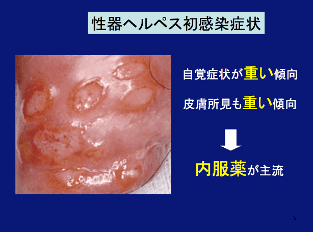 水ぶくれ ペ 二 スポンプ 勃起