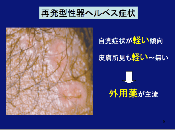 性器ヘルペスの症状と特徴 ウイルス感染症としての対策 Dr Sawamura S性病事典 新宿さくらクリニック