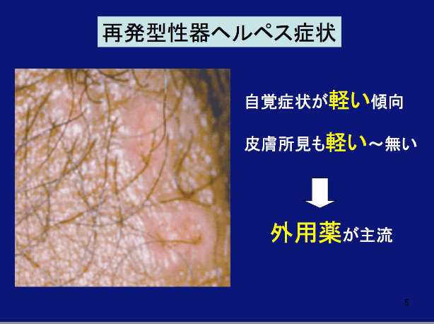 女性 治す 精 早く 器 ヘルペス