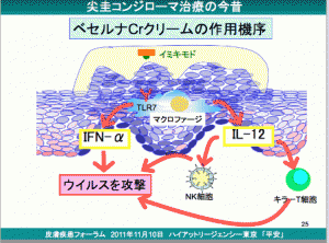 尖圭コンジローマ　新宿さくらクリニック