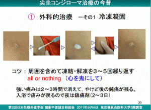 尖圭コンジローマ　新宿さくらクリニック