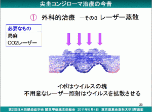 尖圭コンジローマ　新宿さくらクリニック