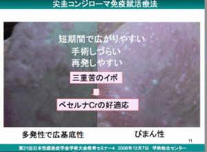 尖圭コンジローマ　新宿さくらクリニック